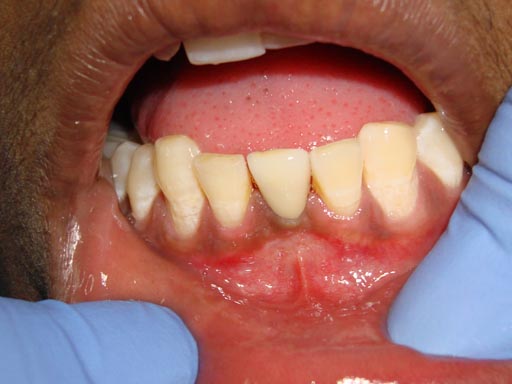 DENTAL LASER CLINIC GUJARAT